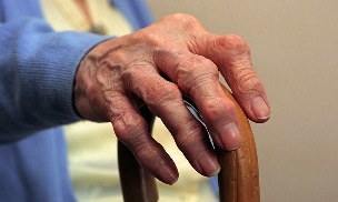 Vyresnio amžiaus žmogaus pirštų artritas ir artrozė