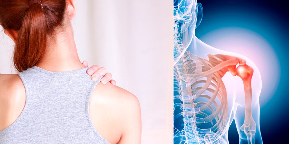 Peties osteoartrito vystymasis palaipsniui sukelia nuolatinį skausmą