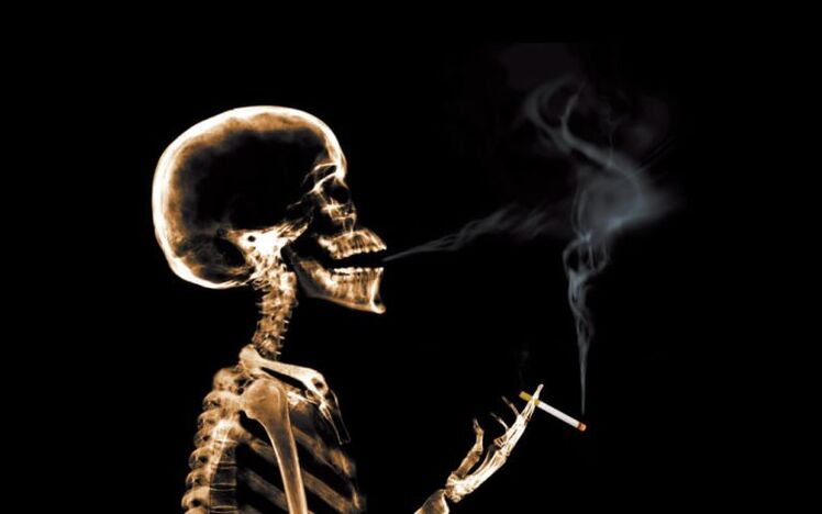 rūkymas kaip nugaros skausmo priežastis pečių srityje