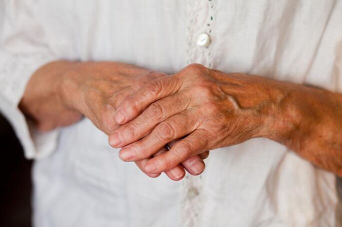 Rankų sąnarių skausmai dažnai vargina vyresnio amžiaus žmones