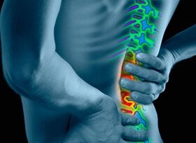 osteochondrozės priežastys ir simptomai