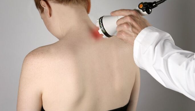Lazerio terapija gimdos kaklelio osteochondrozei