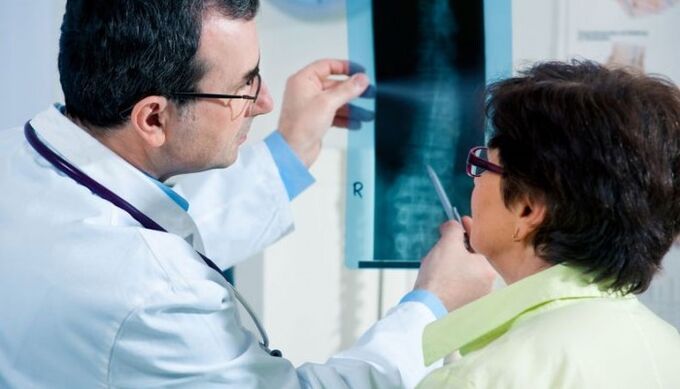 rentgenografija kaip gimdos kaklelio osteochondrozės diagnostikos metodas